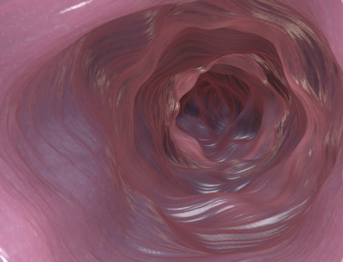 10 Questions You Need to Ask About Colonoscopy